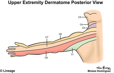 Dermatomes Neurology Medbullets Step 1 Dermatomes Chart And Map