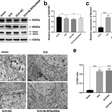 Nlrp6 Knockdown Suppressed Autophagy After Ich In Rats A Western Blot