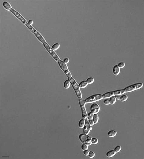 Morphology Of Yeast And Pseudohyphal Forms Of Jey After Overnight