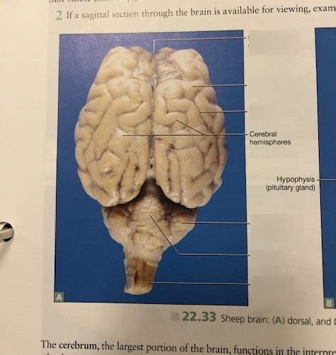 Brain External Labeling Pt 1 Diagram Quizlet