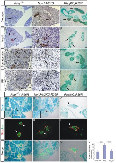 Endocrine Development In RbpjKO Notch1 2KO And Rbpj Pancreata