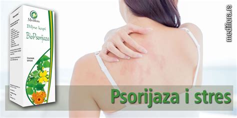 Psorijaza I Stres Mediflora