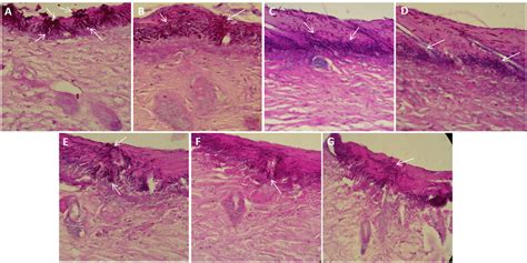 Representative Images Of Mouse Skin Infected With C Albicans And