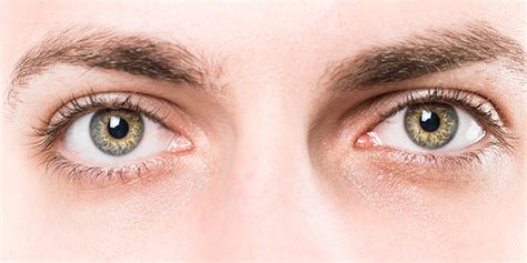 Consejos Para Cuidar Y Limpiar Los Ojos Correctamente Marcas De