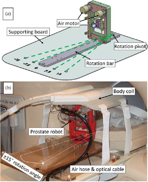 Figure 1 From Robotic System For MRI Guided Focal Laser Ablation In The