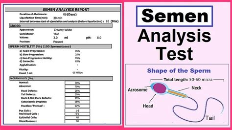 Semen Analysis Procedure