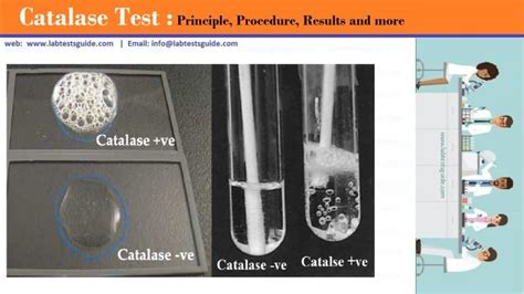 Catalase Test Results Archives | Lab Tests Guide