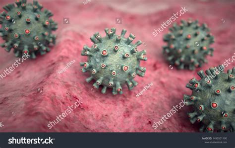 Advanced Hiv Images Stock Photos Vectors Shutterstock