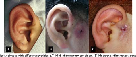 Figure 1 From Decision Making In The Choice Of Surgical Management For