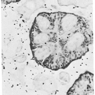 Sh Inulin Autoradiograph Of Medulla Prepared From Tissue Incubated For