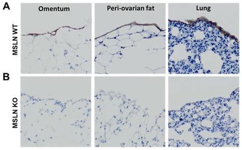 Ijms Free Full Text Host Mesothelin Expression Increases Ovarian