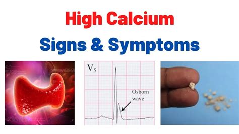 What Happens If Someone Has Too Much Calcium Houston Endocrine Center