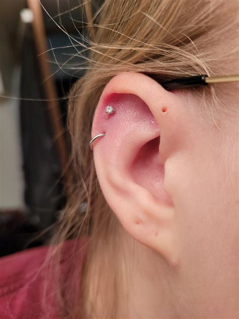 Medical Complications Of Cartilage And Ear Piercing Childrensmd