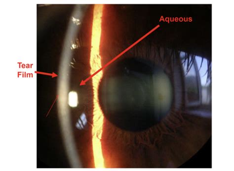 OABP Anatomy Of The Cornea Flashcards Quizlet