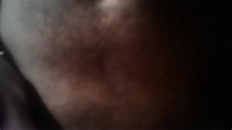 Amputee Surprise Fuck Search XVIDEOS