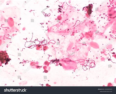 Nocardia Organisms On Auramine O Gram Stock Photo 2230287835 | Shutterstock