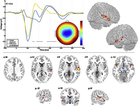 Figure 1 From A Review Of Group ICA For FMRI Data And ICA For Joint