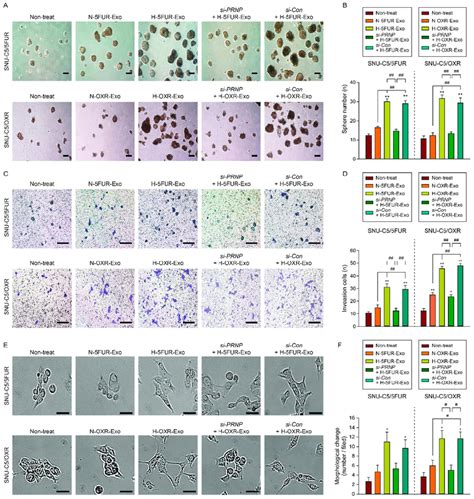 Effect Of Exosomes Secreted By Hypoxic 5fu Resistant Crc Cells On