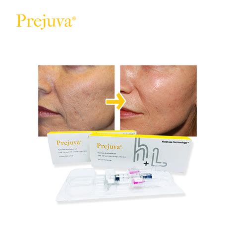 Profhilo Injections The Ultimate Skin Tightening Solution Dermax