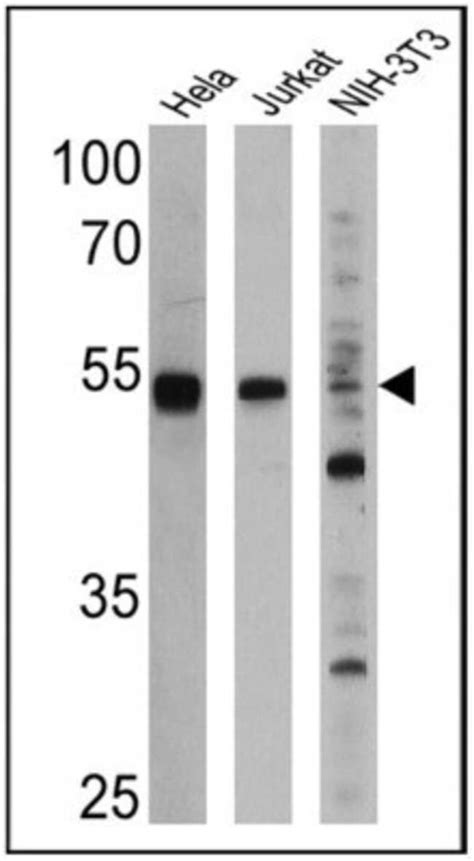 Ppar Alpha Nr C Antibody B Ppar Bsa Free Ug Unconjugated