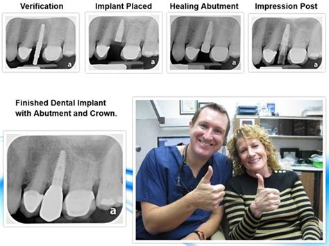 Dr Michael Nugent Texas Dental Implants