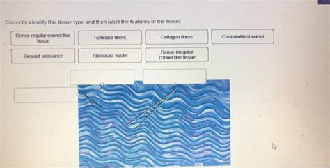 Correctly Identify This Tissue Type And Quiz