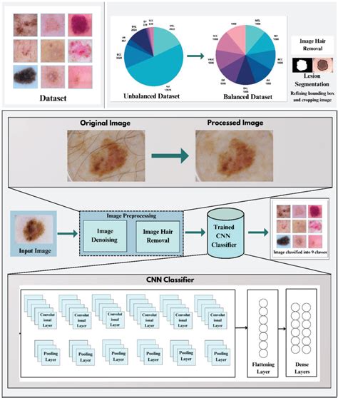 Figure 4 From Image Based Classification Of Skin Cancer Using