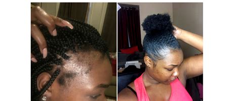 3 Hairstyles that make you lose your edges