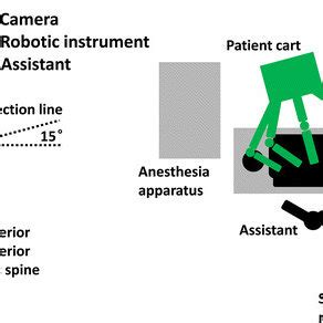 Trocar location and operating room setup for left colic flexure... | Download Scientific Diagram