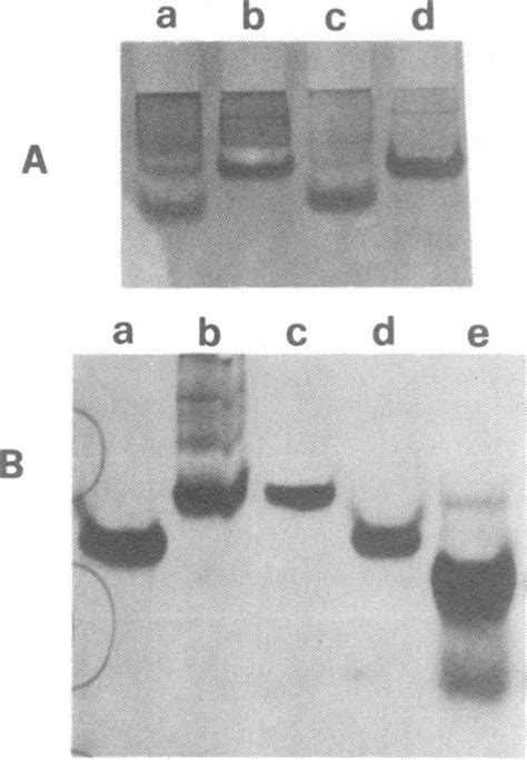 A Non Denaturing 20 Polyacrylamide Gel Electrophoresis In 50 Mm Download Scientific Diagram