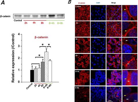 Figure From Fluid Shear Stress Induces Epithelial Mesenchymal