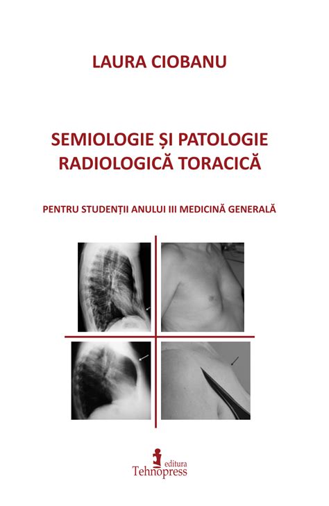 Pdf Semiologie I Patologie Radiologic Toracic Pentru Studen Ii