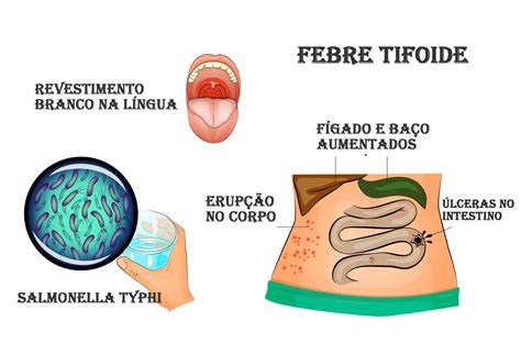 O Que é Etiologia Da Doença