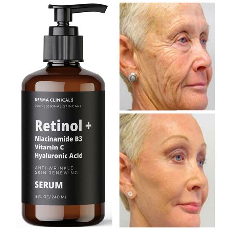 Retinol And Vitamin C Serum Discount | cityofclovis.org