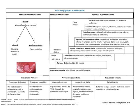 Historia Natural De La Varicela Pdf Medicina Clinica Enfermedades