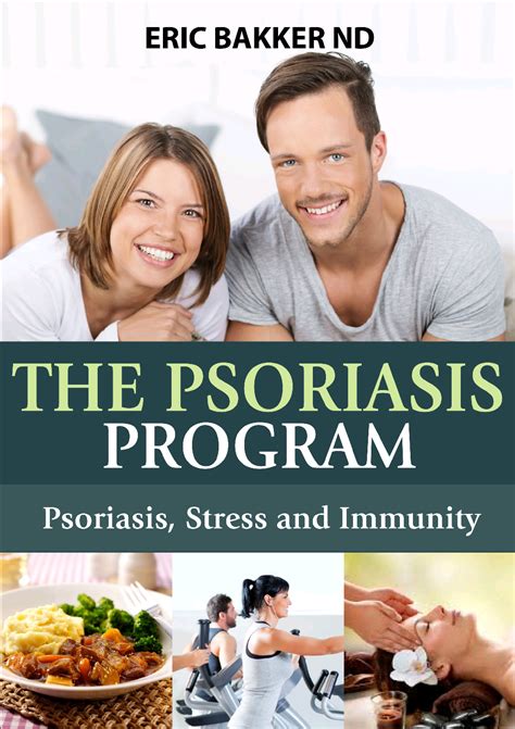 Natural Psoriasis Treatment | Natural Psoriasis TreatmentNatural Psoriasis Treatment