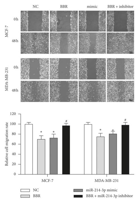 Scratch Wound Healing Assays Mcf 7 And Mda Mb 231 Cells Were Cultured Download Scientific