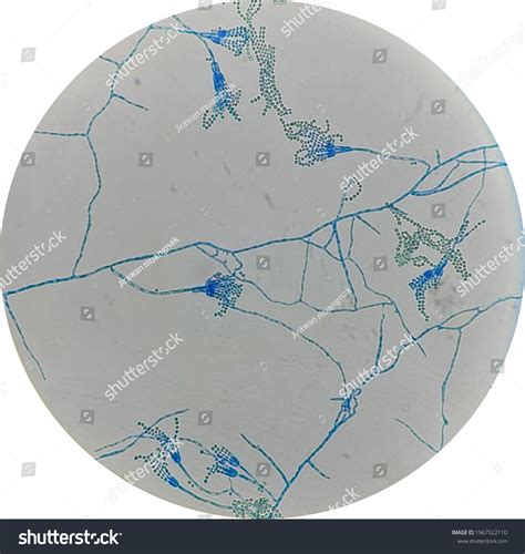 Penicillium Spp Conidia Septate Hyphae Under Stock Photo 1967522110