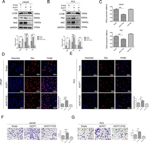 ACAT1 Plays A Tumor Promoting Role Through FUS A And B After A