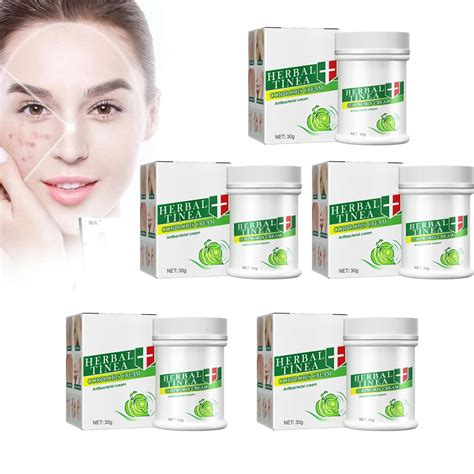 Buy New Al Tinealess Cream Tinea Versicolor Tinea Skin Cream Al Tinea