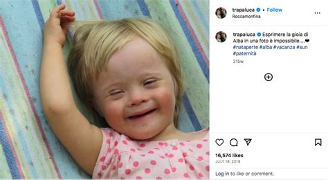 Single Gay Dad Adopts Baby Girl With Down Syndrome Who Was Rejected By