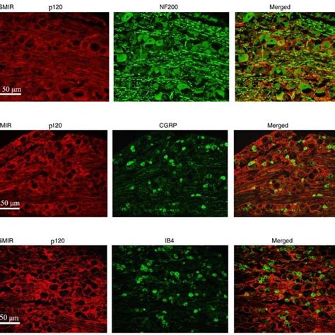 Immunofluorescence staining. Immunofluorescence staining demonstrated... | Download Scientific ...