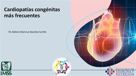 Cardiopatías Congénitas Mas Frecuentes Adilene Udocz