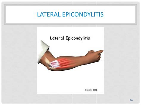 shoulder  elbow orthopedic problems overview powerpoint