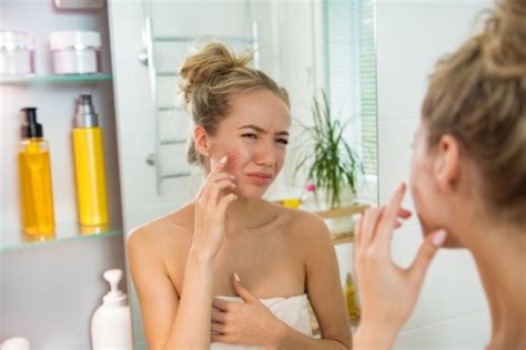 Акне: что это и как с этим бороться? | Polyclinica