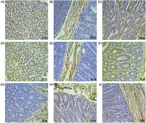 Siga Expression In The Middle Jejunum Distal Jejunum And Distal Ileum Download Scientific