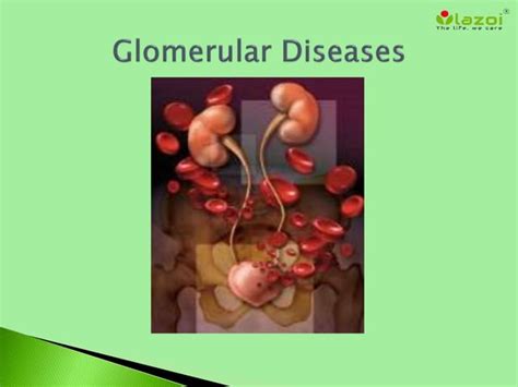 Glomerular Diseases Ppt