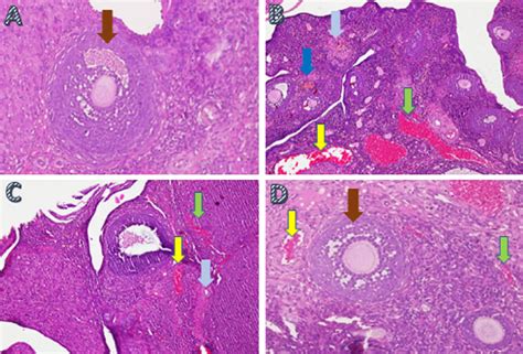 The Ovarian Tissue Regeneration Through The Method Of Histopathology