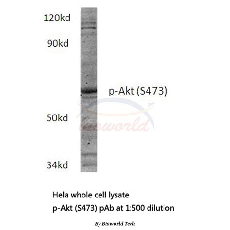 Anti Akt Phospho S473 Antibody A27291