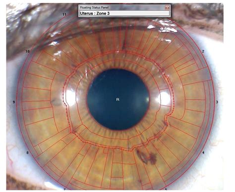 Iridolog A Mapas Del Iris O Cartograf A Cursos De Medicina Natural